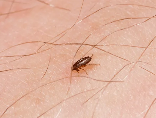 Dedetização de Pulgas na Barra Funda